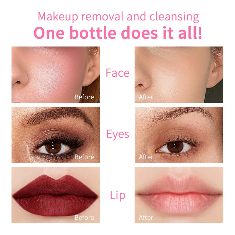 Micellar Cleansing Water Makeup Remover for Face and Eyes